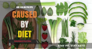 Colon Polyps: Is Your Diet to Blame?