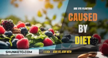 Eye Floaters: Can Diet Cause This?