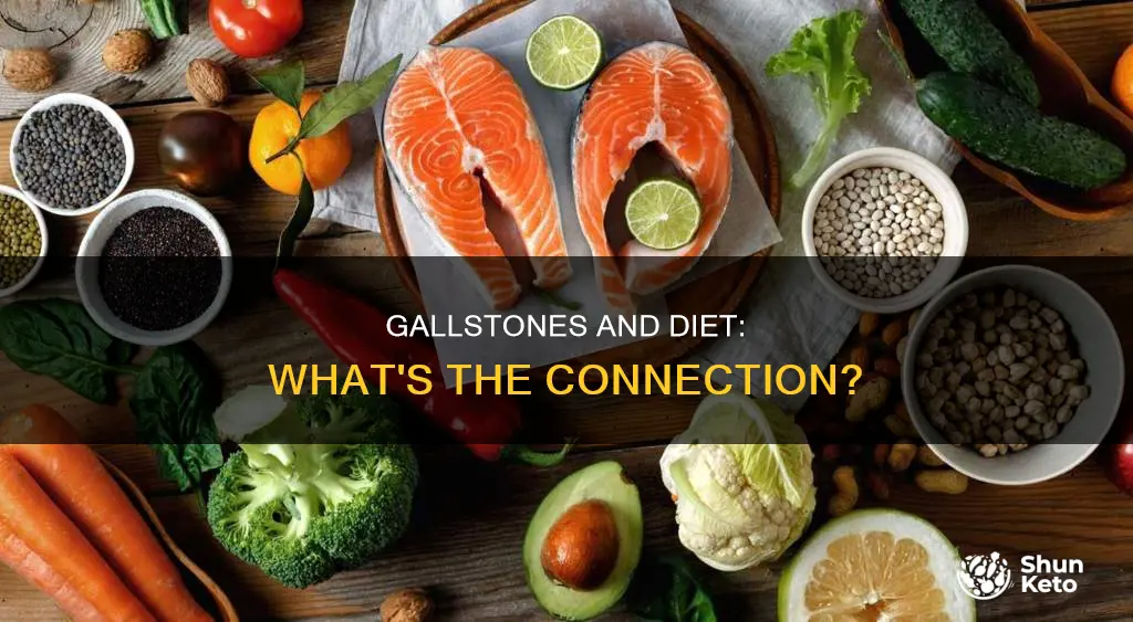 are gallstones caused by poor diet