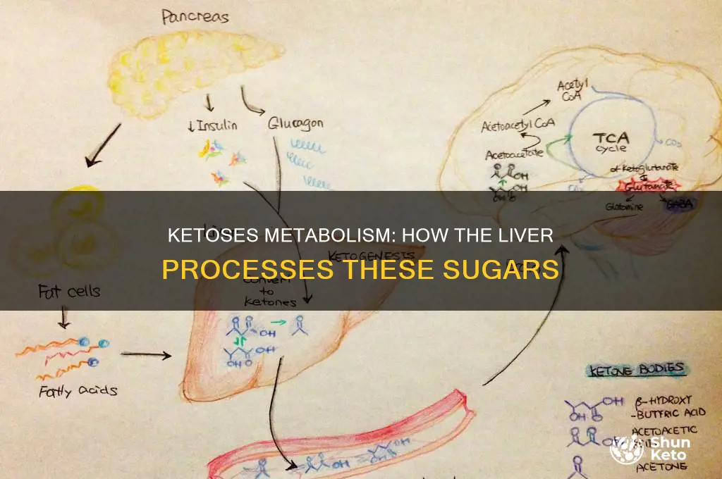 are ketoses metabolized in the liver