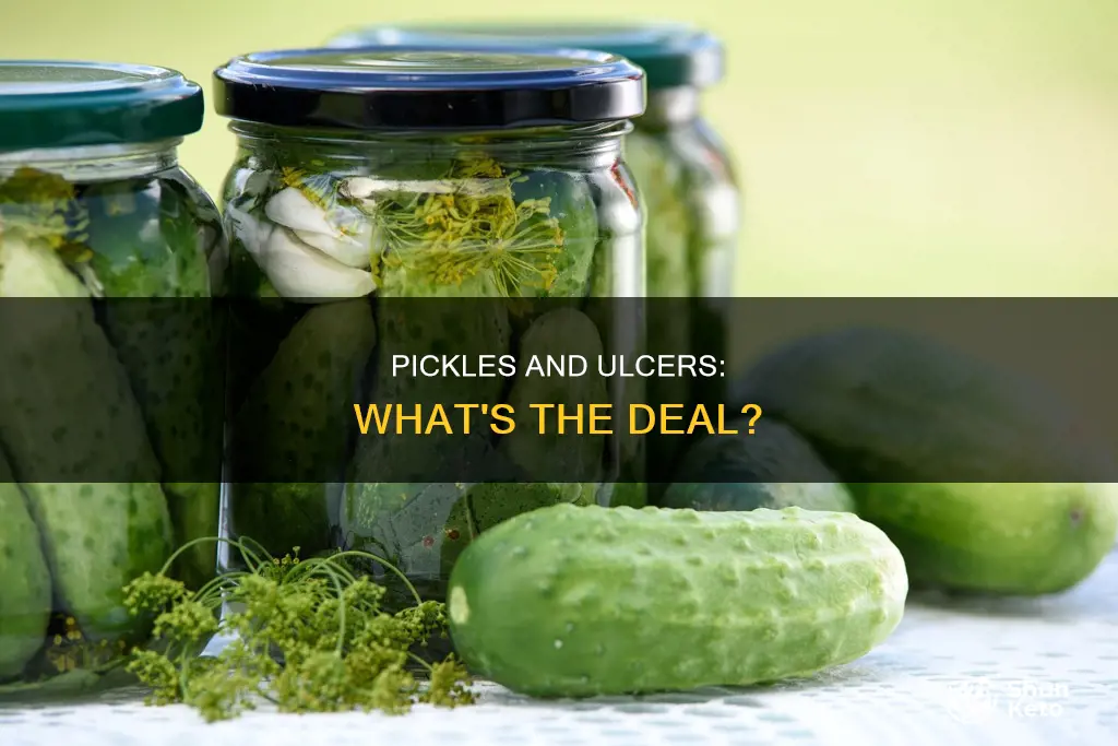 are pickles ok on an ulcer diet
