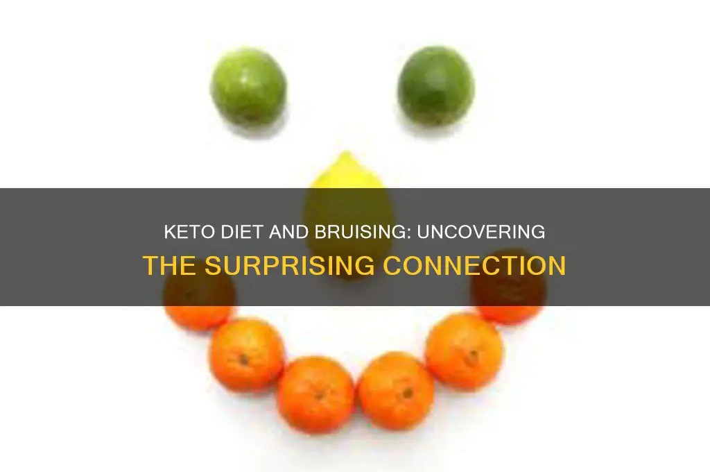 can a keto diet cause bruising