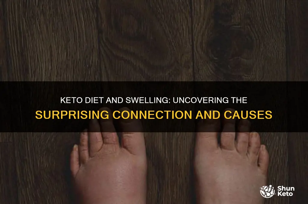 can a keto diet cause swelling