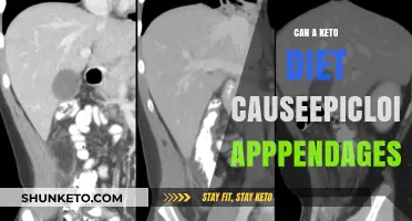 Keto Diet and Epiploic Appendages: Unraveling the Connection
