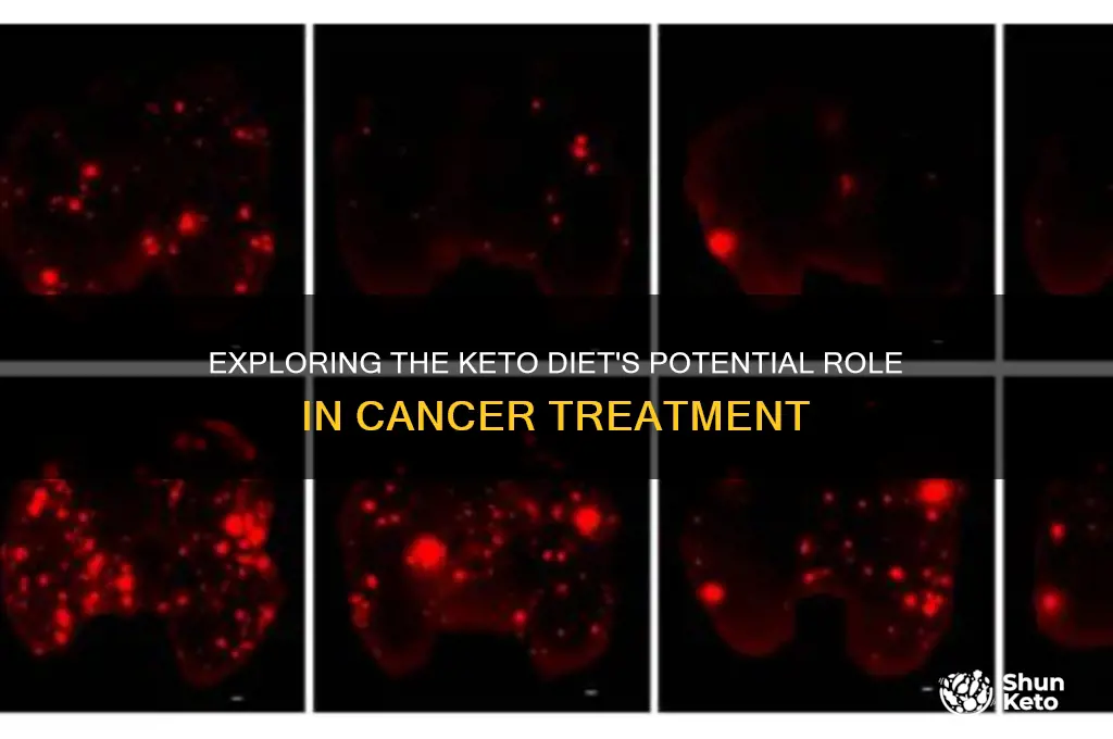 can a keto diet cure cancer