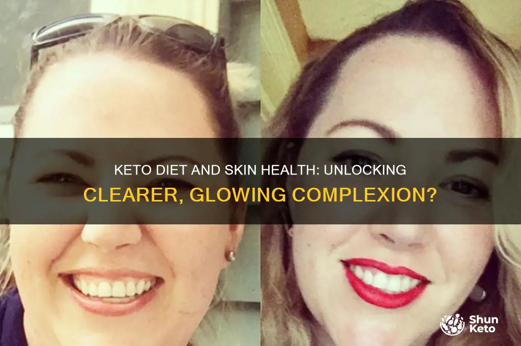 can a keto diet help my skin