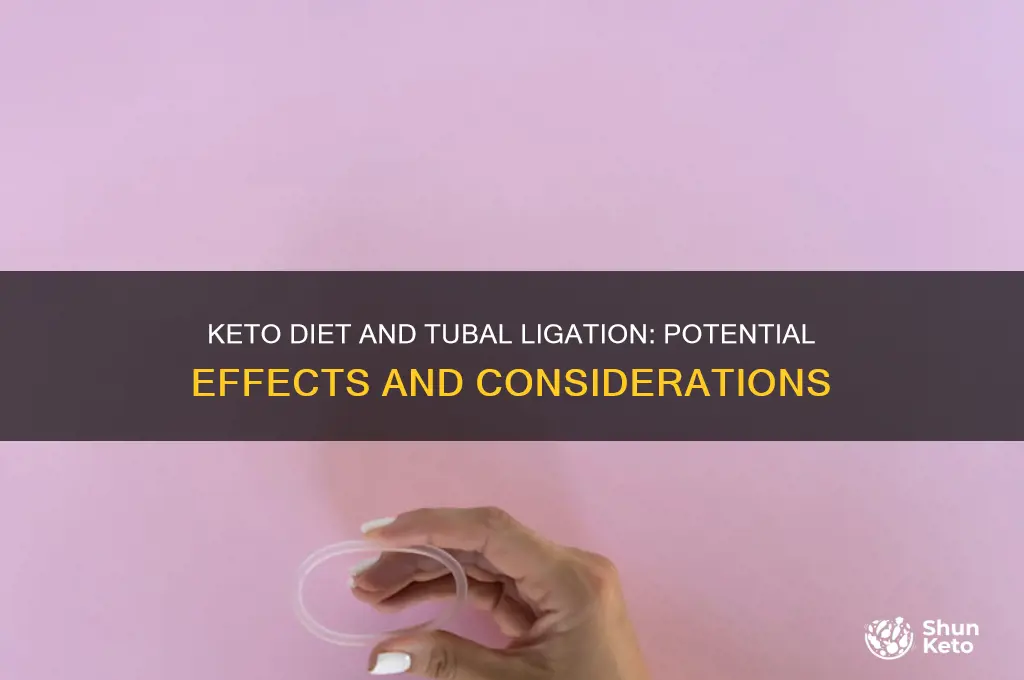 can being on keto effect a tubal ligation