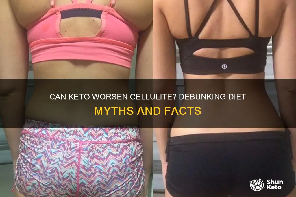 can cellulite get worse on keto diet