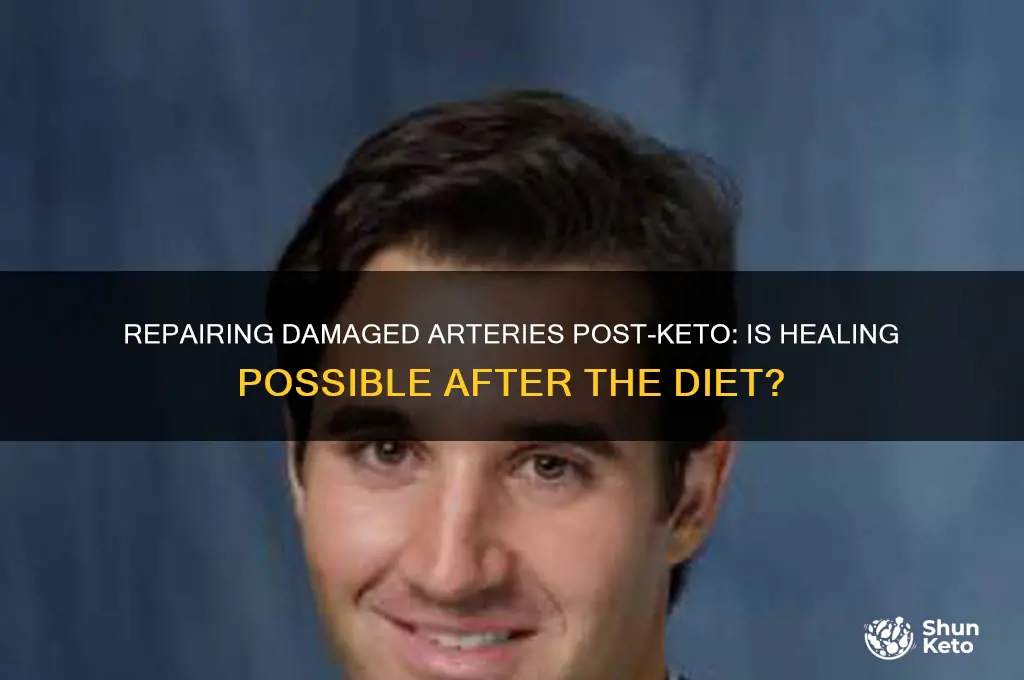 can damaged arteries be repaired after keto