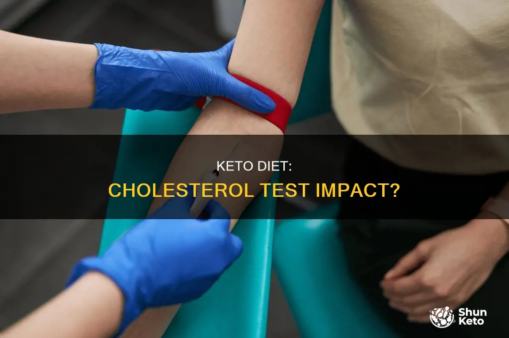 can eating keto affect cholesterol tests
