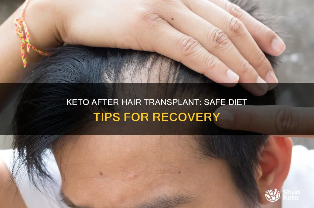 can i go on keto after hair transplant