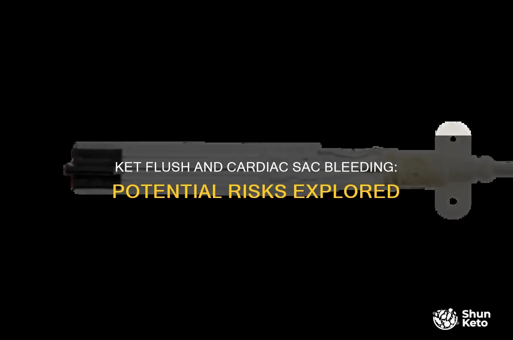 can ket flush cause bleeding in the cardiac sac