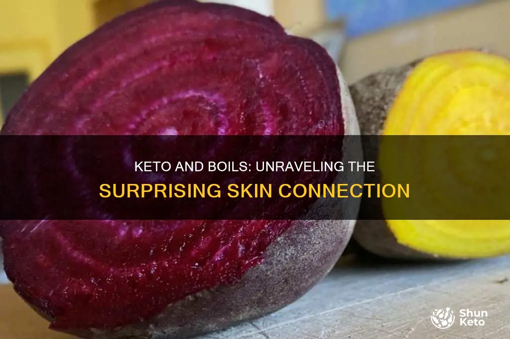 can keto bring about boils