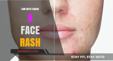 Keto and Skin Health: Understanding the Link to Facial Rashes