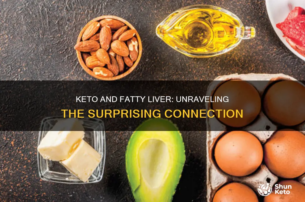 can keto cause a fatty liver