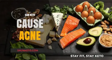 Keto and Acne: Unraveling the Diet's Impact on Skin Health