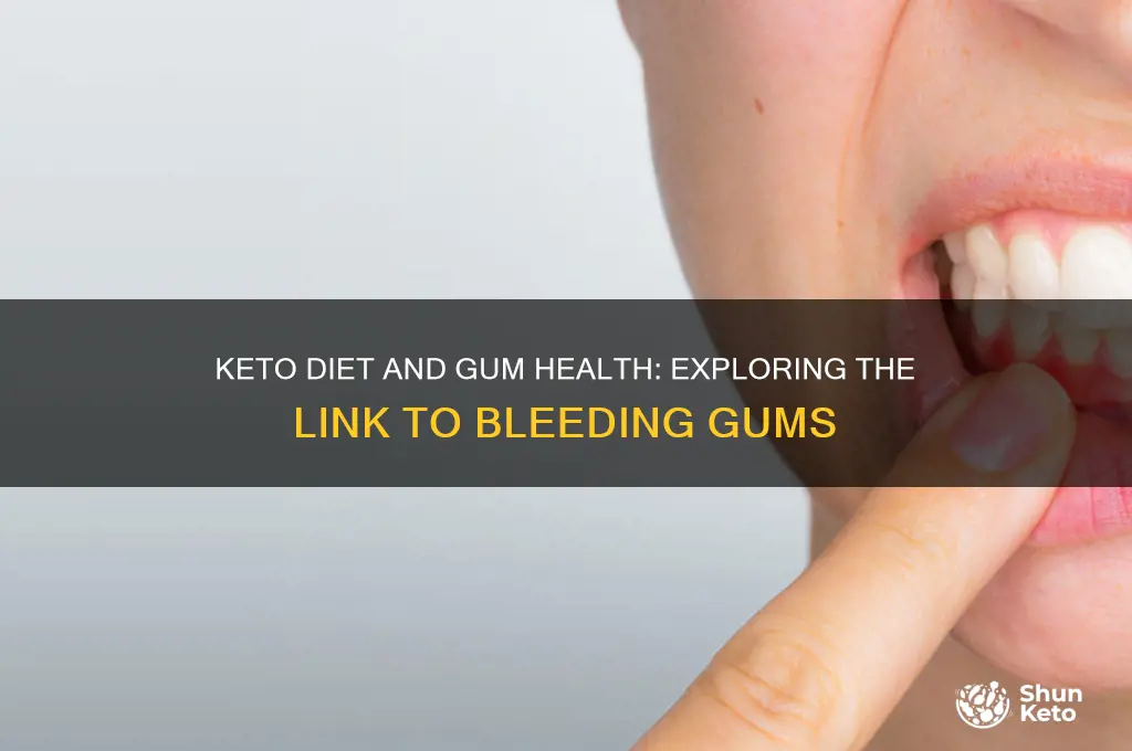 can keto cause bleeding gums