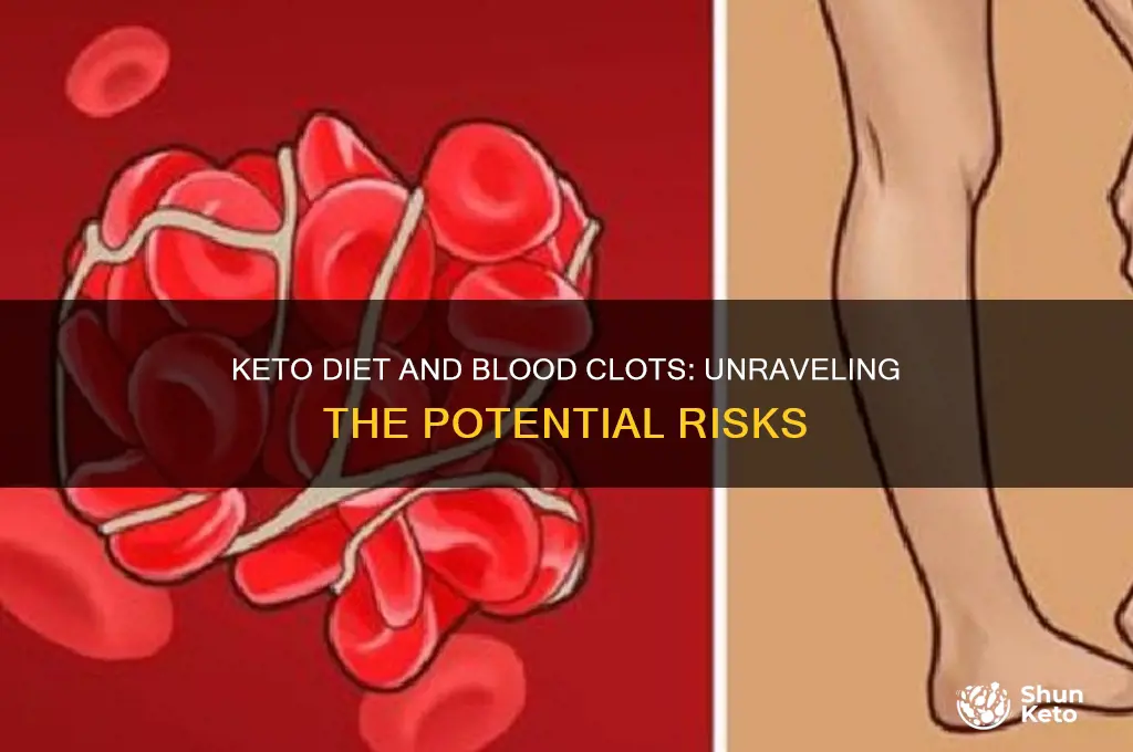 can keto cause blood clots