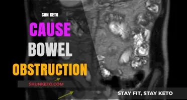 Keto Diet and Bowel Obstruction: Unraveling the Potential Connection