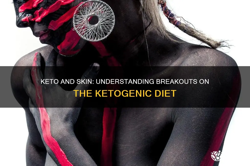 can keto cause breakouts