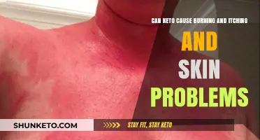 Keto Diet Side Effects: Burning, Itching, and Skin Issues Explained