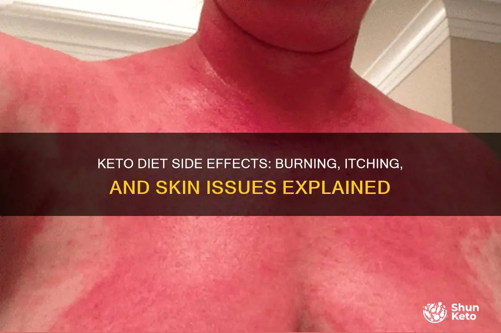 can keto cause burning and itching and skin problems