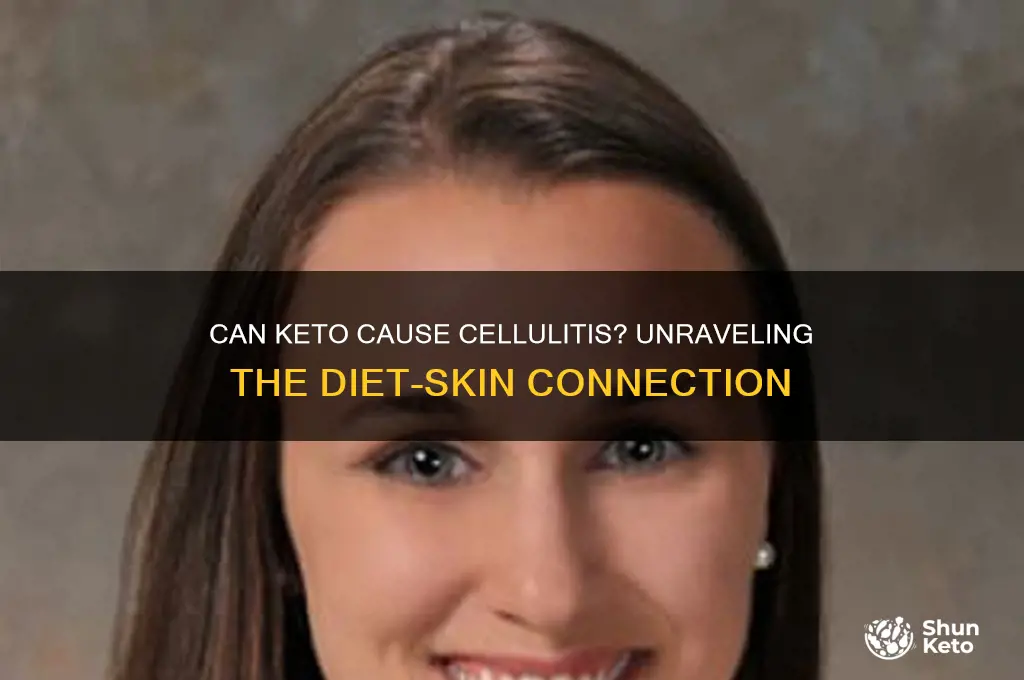 can keto cause cellulitis