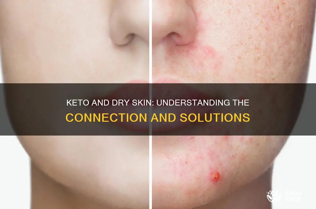 can keto cause dry skin