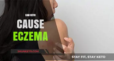 Keto and Eczema: Exploring the Potential Diet-Skin Connection