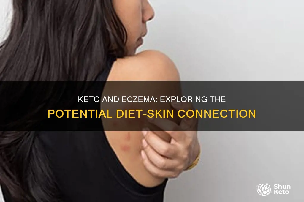 can keto cause eczema