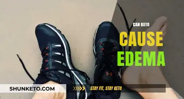 Can Keto Cause Edema? Understanding Fluid Retention on a Low-Carb Diet