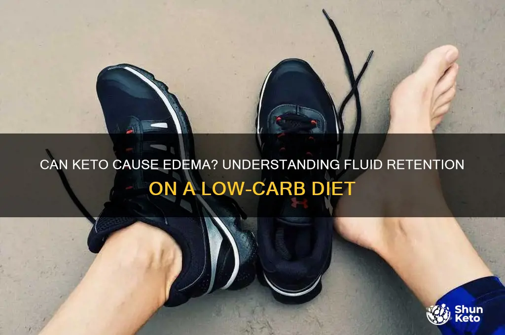 can keto cause edema
