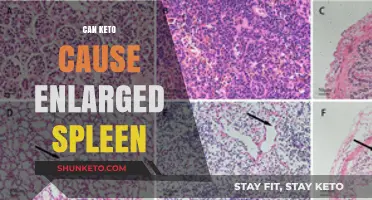 Keto Diet and Enlarged Spleen: Unraveling the Potential Connection
