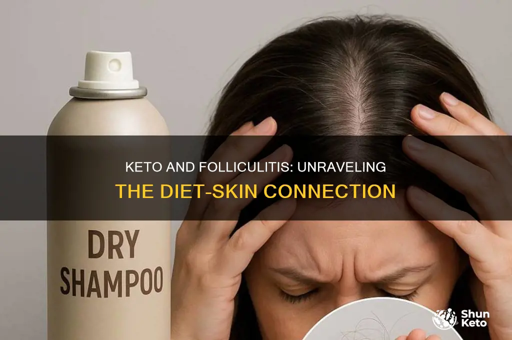 can keto cause folliculitis