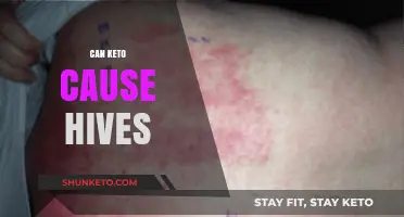Can Keto Cause Hives? Exploring Diet-Related Skin Reactions