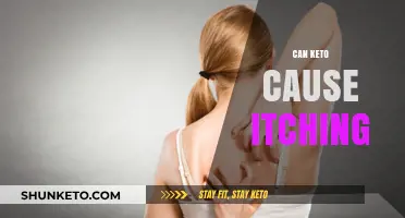 Keto Itching Explained: Causes, Remedies, and Prevention Tips
