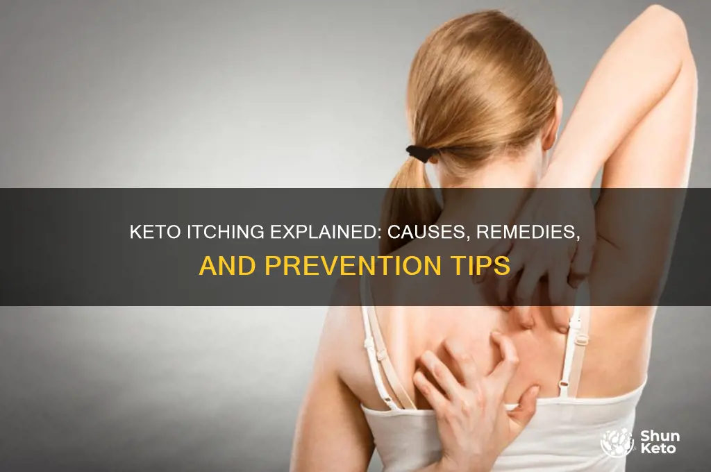 can keto cause itching