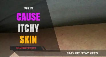 Keto and Itchy Skin: Understanding the Connection and Remedies