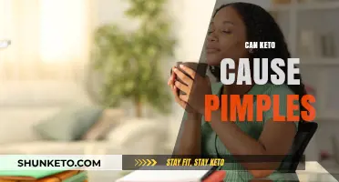 Keto and Acne: Unraveling the Link Between Diet and Pimples