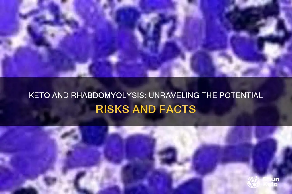 can keto cause rhabdomyolysis