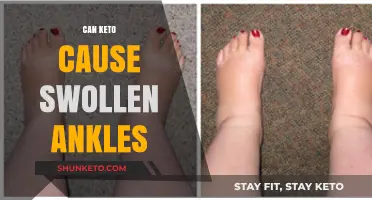 Keto and Swollen Ankles: Understanding the Potential Connection