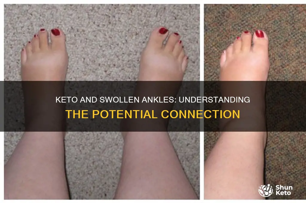can keto cause swollen ankles