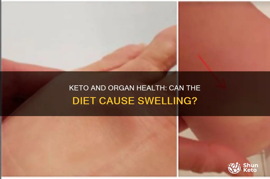 can keto cause swollen organs