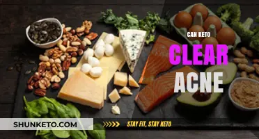 Keto Diet and Acne: Can Low-Carb Eating Clear Your Skin?