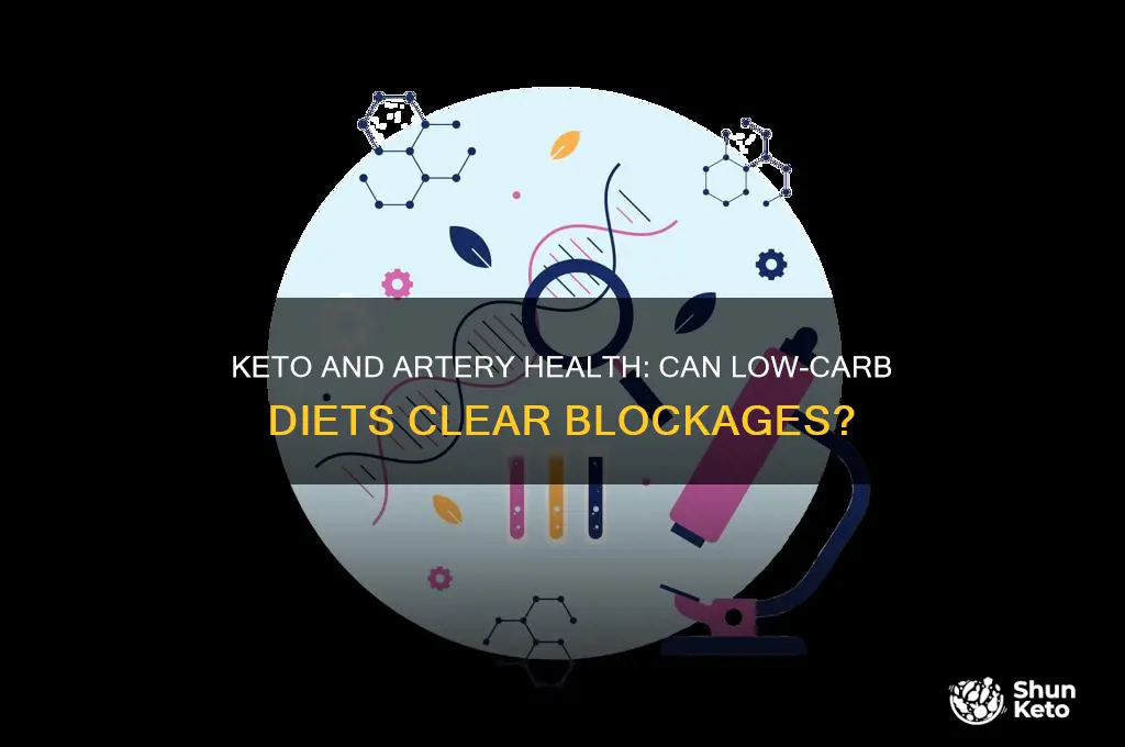 can keto clear your artiers