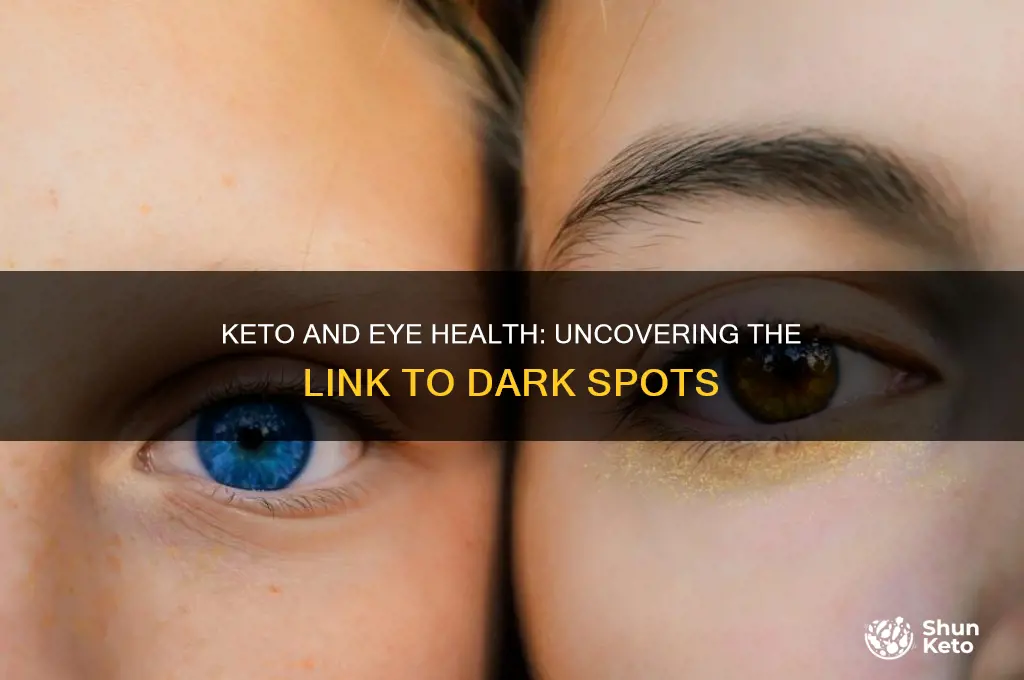 can keto create dark spot in eyes