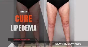 Can Keto Cure Lipedema? Exploring Diet's Role in Managing Symptoms