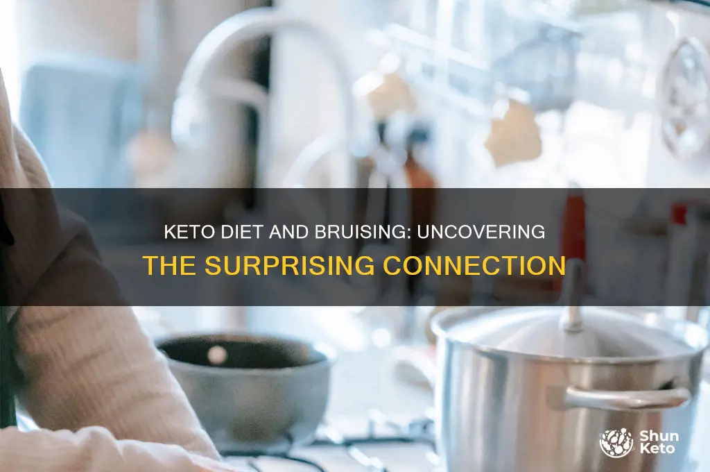 can keto diet cause bruising