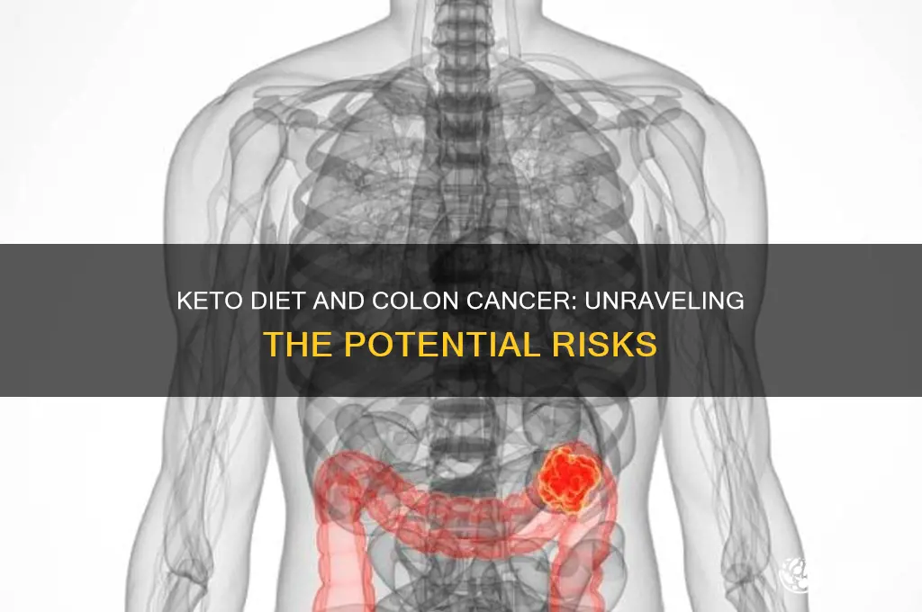 can keto diet cause colon cancer