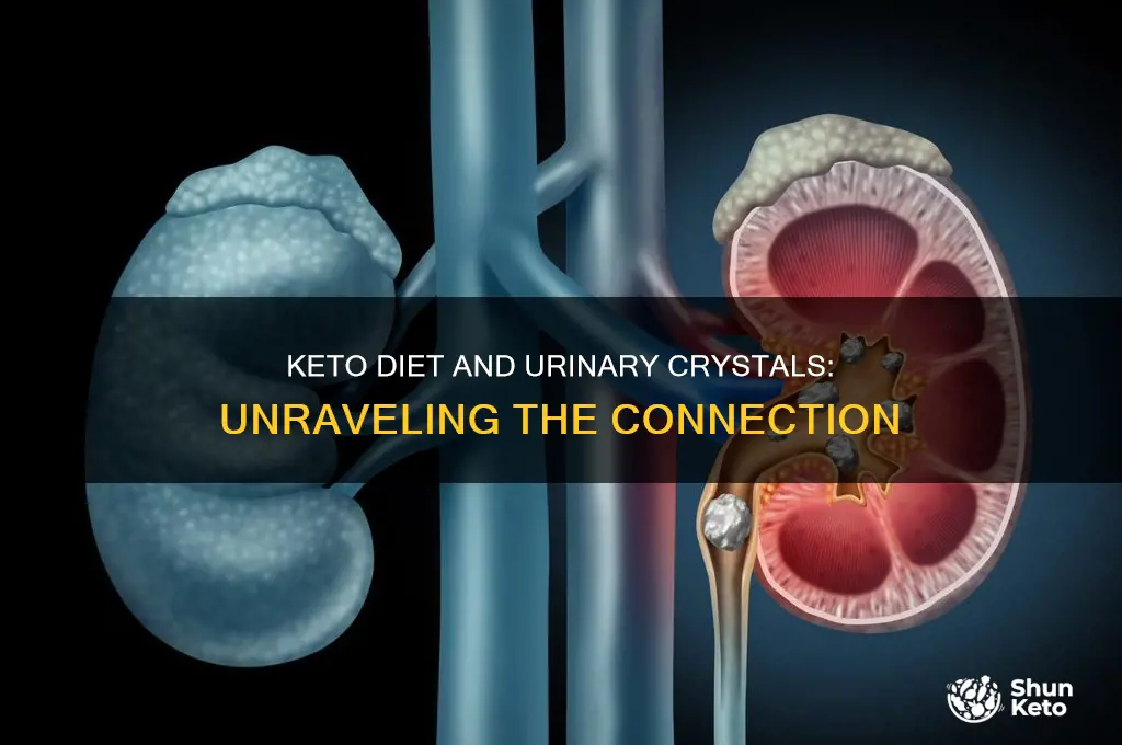 can keto diet cause crystals in urine